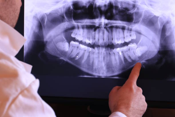 Best Broken Tooth Emergency  in Mshall, AR